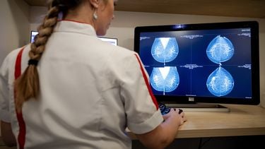 borstkankerscreening, bevolkingsonderzoek, borstkanker, onderzoek