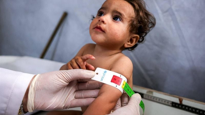 Baby's Gaza ondervoeding