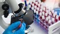 pfas, bloed, gezond, gezondheid, RIVM