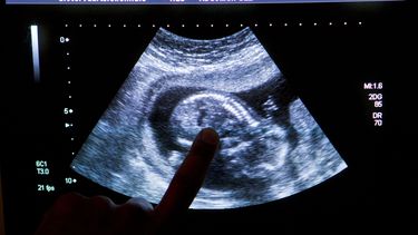 Foetus na abortus ingeschreven in bevolkingsregister