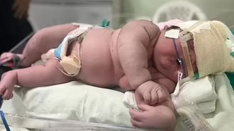 Baby van 7,3 kilo geboren in Brazilië