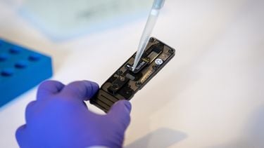 tuberculose tbc