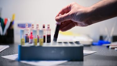 hiv diagnoses, gezondheid, Nederland