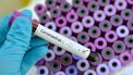 Viroloog: niet teveel inzoomen op de Britse coronavirus variant