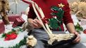 Slachtoffer gebruikt geamputeerd been als decoratie: 'Het inspireert om door te gaan'