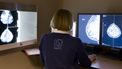 Een radioloog bekijkt digitale rontgenfoto's mammografie in de onderzoeksunit van de Stichting Bevolkingsonderzoek Borstkanker in Rotterdam.