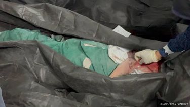 epa12784464 A handout picture made available by the Iranian foreign press department shows victims at an Iranian school for girls in the city of Minab after a Israeli-US airstrike, in southern Iran, 28 February 2026. At least 85 girl students were killed and around 100 injured in the airstrike on Minab, according to the Iranian foreign press department. A joint Israeli and US military operation targeted multiple locations across Iran in the early hours of 28 February 2026.  EPA/HANDOUT ATTENTION: GRAPHIC CONTENTHANDOUT EDITORIAL USE ONLY/NO SALES