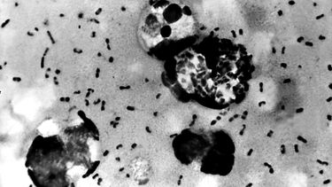 Een foto van het virus dat leidt tot de builenpest