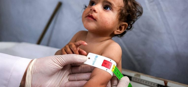 Baby's Gaza ondervoeding