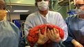 'Bierbuik' blijkt enorme tumor van 13 kilo