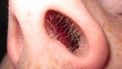 Bizarre nieuwe beautytrend: de 'neushaarextensions'